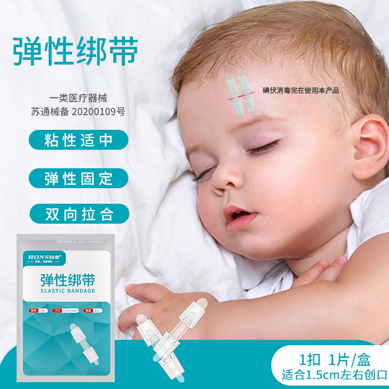 ホンシェン張力緩和器、縫合不要創傷閉鎖器、不織布ジッパー式創傷パッチ、皮膚張力緩和吻合器