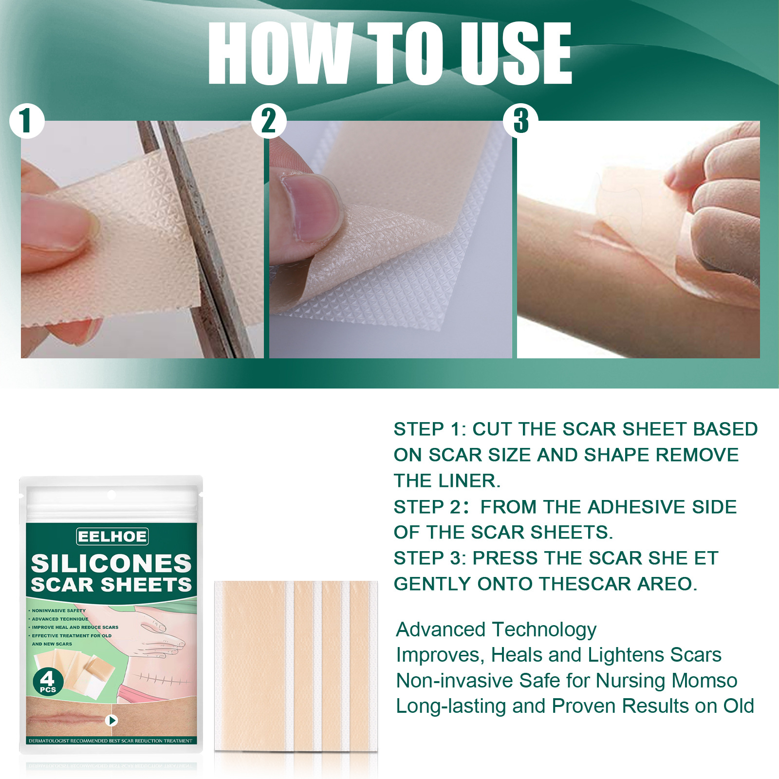 EELHOE silikono gelio gėlinimo operacija nėštumas raukšlės nudegimas randas lopas lygi oda žaizdų taisymas_voghion.com