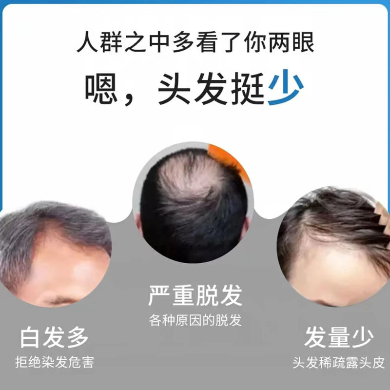 男士假发头套真发毛寸短发造型自然隐形轻薄透气假发男士全头套|undefined