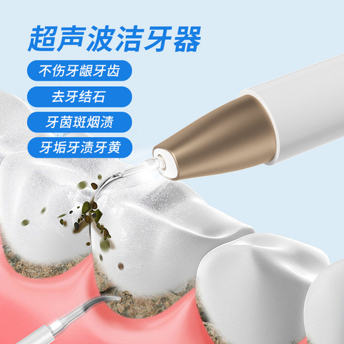 New trendy dental cleaner: Ultrasonic tooth-cleaning device for quick removal of stains and tartar—perfect for dissolving buildup at home.
