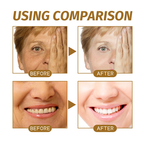 EELHOE Rice Powder Cream Deeply Hydrates, Nourishes, Repairs Skin Barrier, Fades Age Spots, Whitens, and Evens Skin Tone.