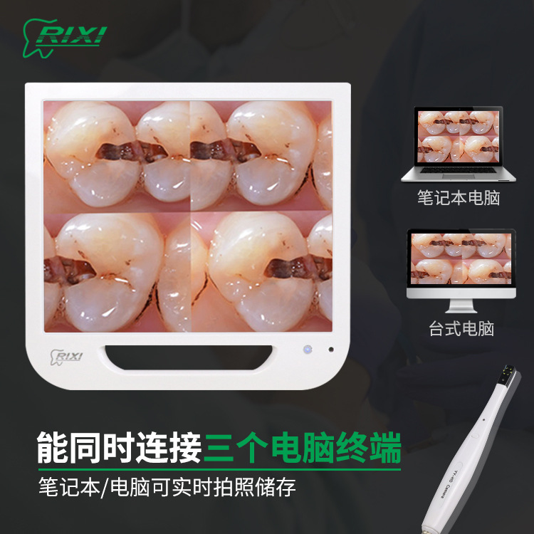 Endoscopio dental visual todo en uno Wifi cámara oral multimedia endoscopio dental de alta definición