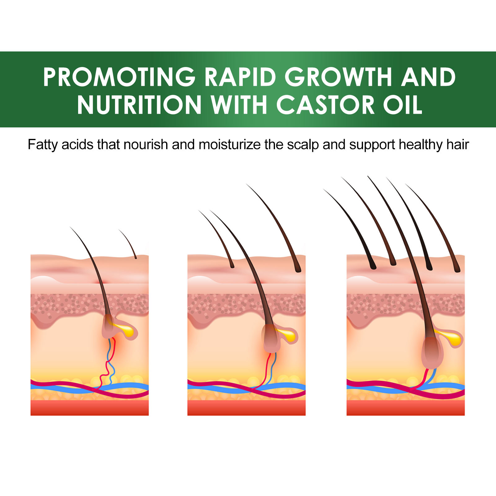 EELHOE rīcineļļa matiem, biezs šķidrums pret matu izkrišanu, nostiprinošs, bieziem matiem, galvas ādas masāža, barojošs šķidrums_voghion.com