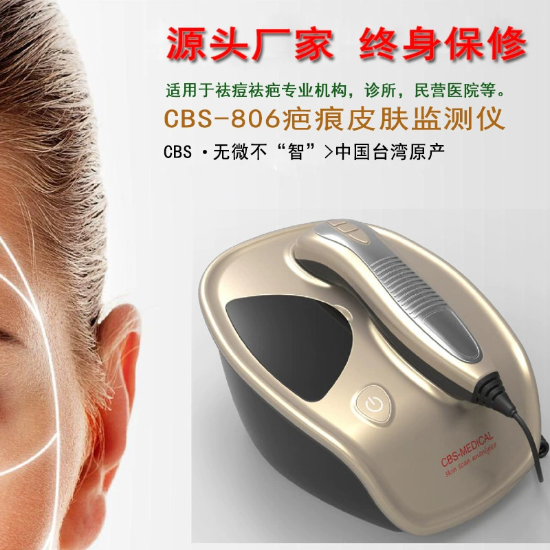 [Пожизненная гарантия] CBS-806 портативный тестер детектора пятен на коже монитора шрамов