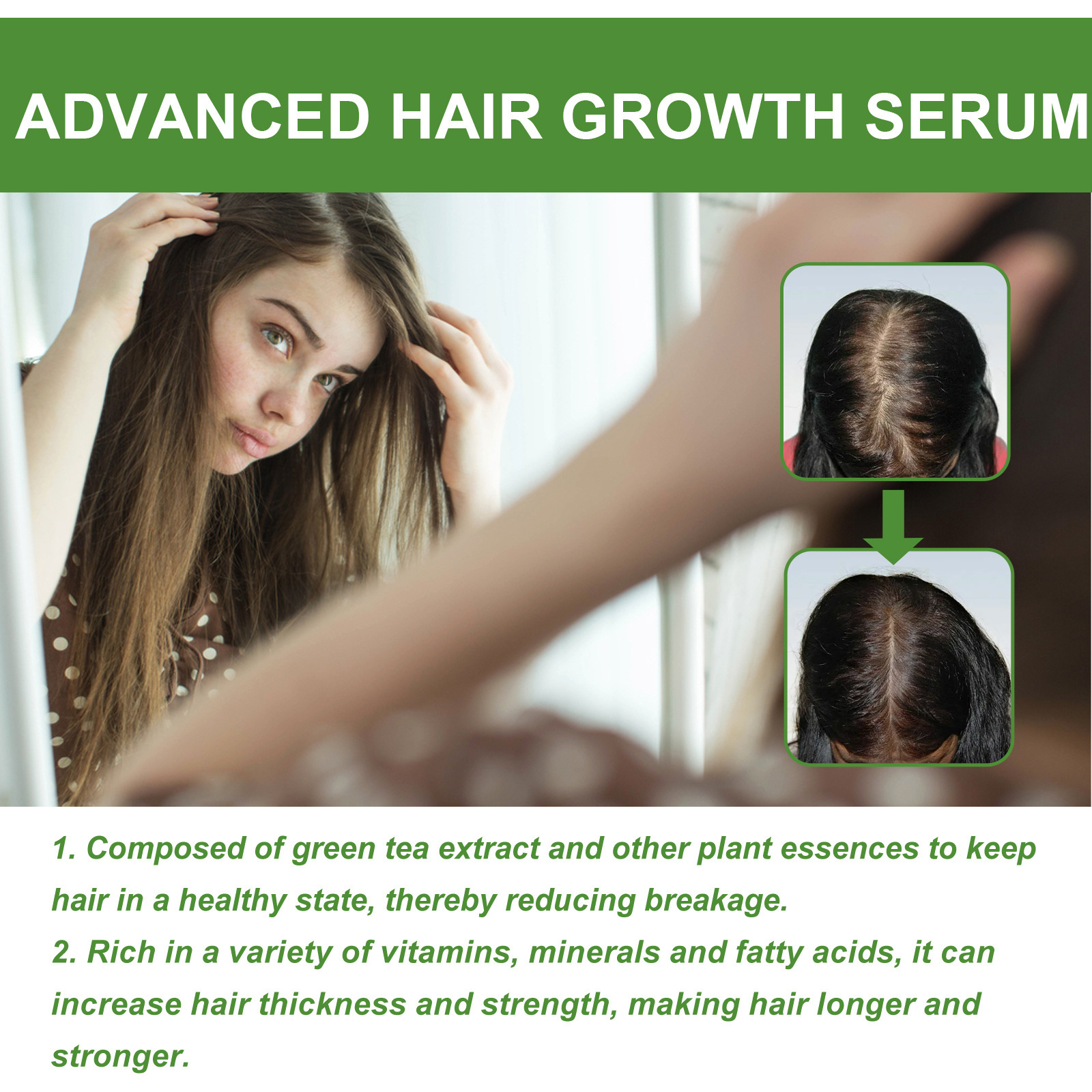 EELHOE Hair Essence Spendet Feuchtigkeit für die Haarwurzeln, pflegt die Kopfhaut, sorgt für kräftiges Haar, beugt Haarausfall vor und verdickt das Haar_voghion.com