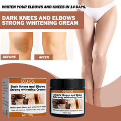 EELHOE Joint Whitening and Brightening Cream, Fading Darkness, Nourishing and Brightening Skin for Joints, Elbows, and Whitening Repair Cream