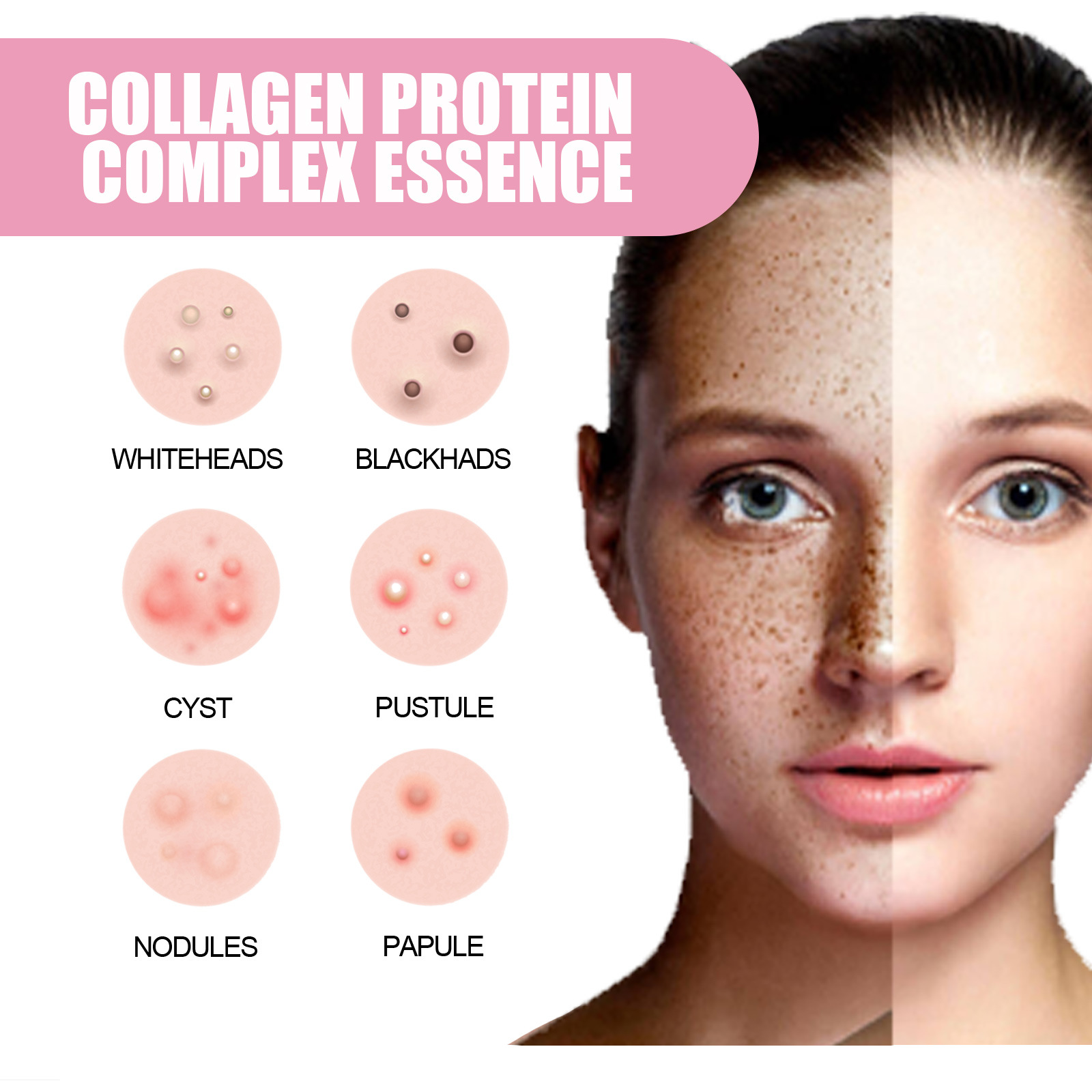 La Solution d'essence de collagène d'essence d'embryon de mouton EELHOE soulève, resserre, améliore le tonus, éclaircit les taches, hydrate et_voghion.com