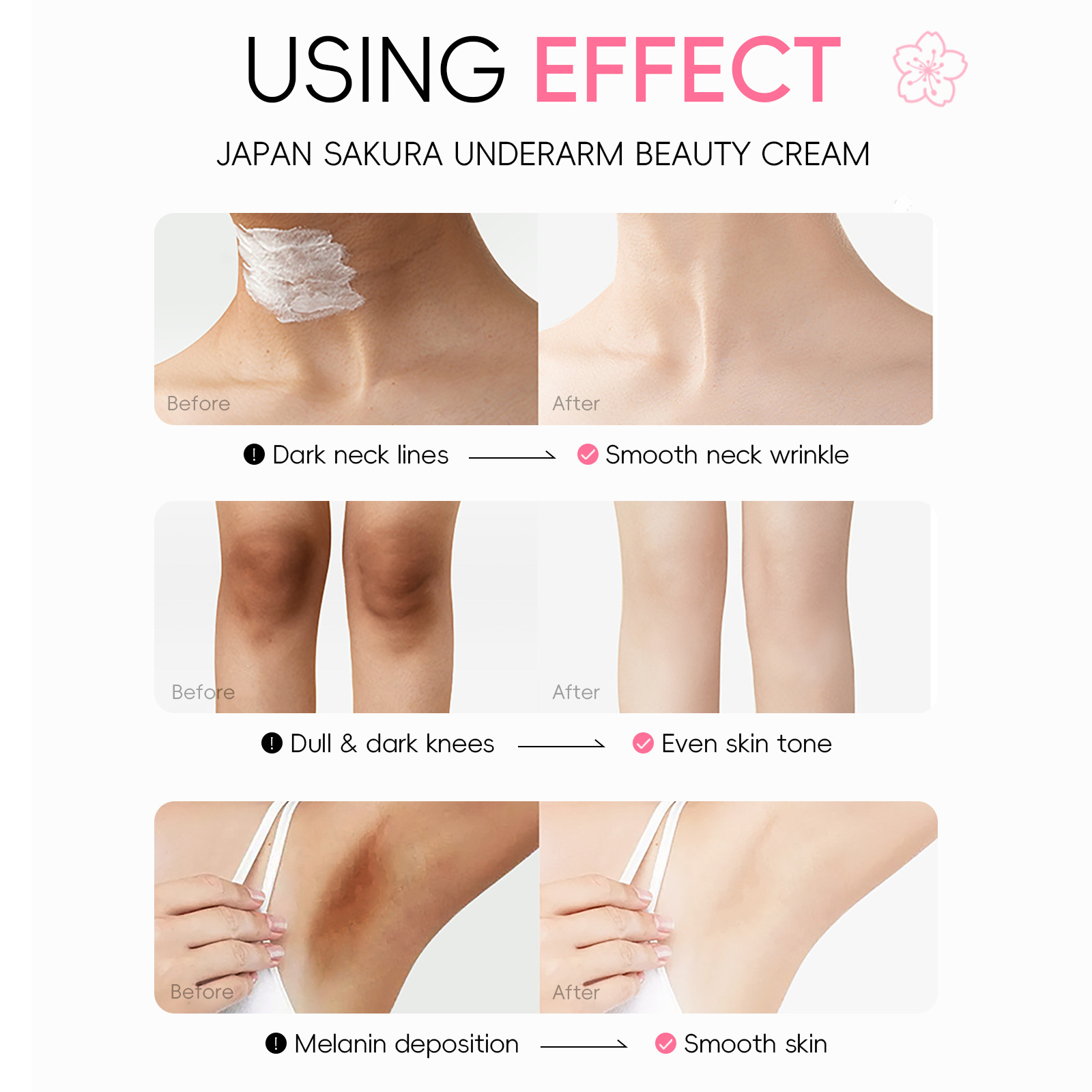 Cross-border LAIKOU Japanese Cherry Blossom Armpit Cream 30g Hydrating, Moisturizing and brightening Skin tone manufacturer wholesale supply undefined