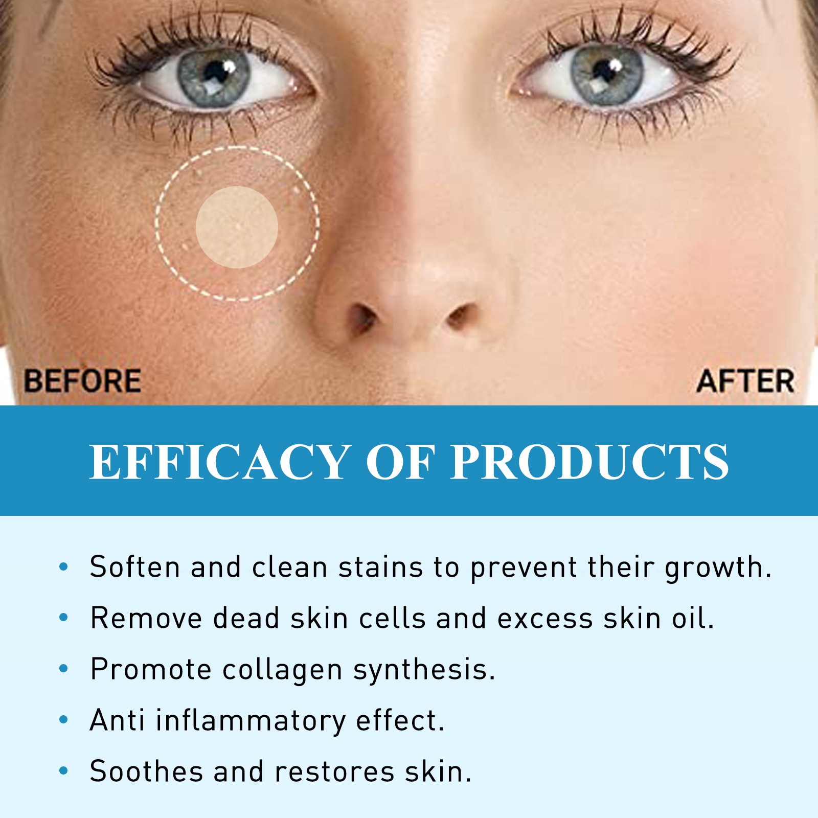 Lõunakuu rasv õligraanulite eemaldamiseks, näo nahaalused massid, tavaline higipiibu graanulite parandav plaaster_voghion.com