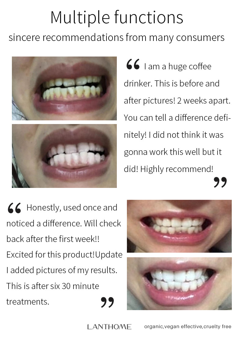 牙齿美白洁牙慕斯_08