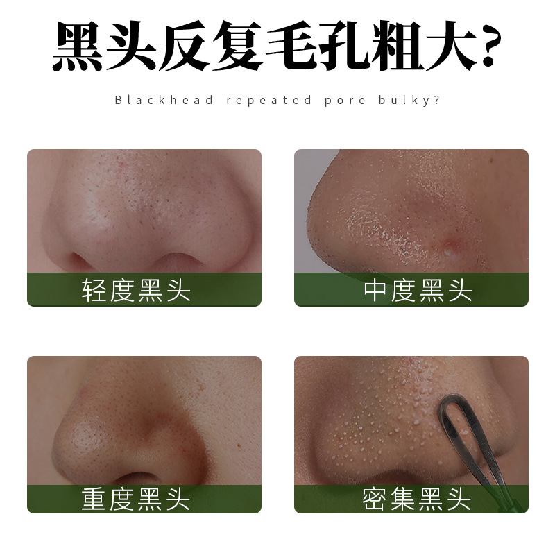 Aopy Oligopeptide Blackhead Removal Essence Set t Zone Cleansing Blackhead Care Blackhead Export Liquid Nose Patch Care Essence