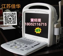 便携式电子凸阵B型超声诊断仪  便携式线阵扫描B型超声诊断仪工厂