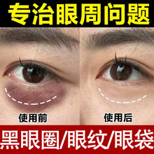 ��˪����ȥ��Ʒ���y�۴�����Ȧ���Ƽ��y֬�����۲��o��������˪