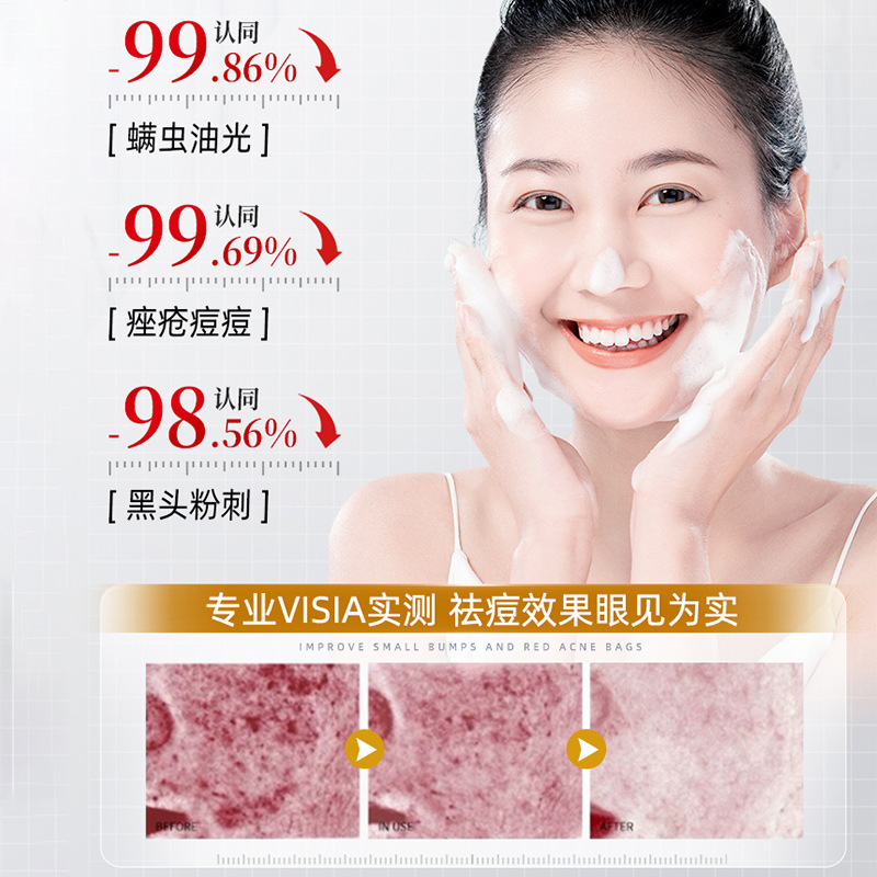 南京同仁堂蛇胆硫磺控油净颜洁面乳深层清洁收缩毛孔除螨洗面奶|undefined