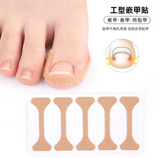 I-Shaped Nail Stickers, Nail Groove Inward Curling Correction and Stretching, Glue-Free Ingrown Toenail Pads