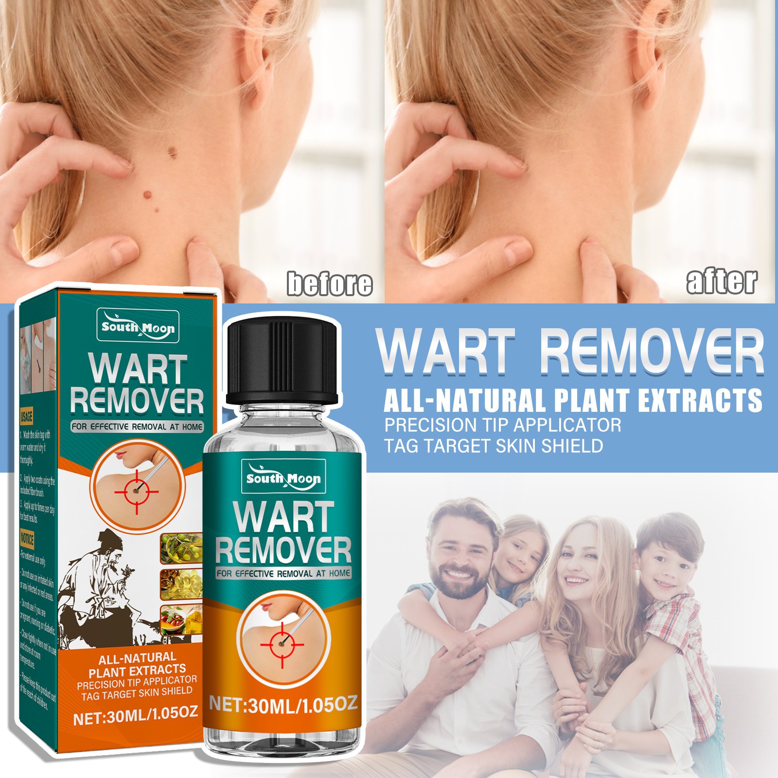 remover, skin removal, flat skin, especially calluses on hands feet, and chicken eye wart remover_voghion.com