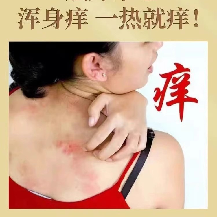 雲南菌王ハーブクリーム皮膚外用抗菌かゆみ止めクリーム水虫ピーリング乾燥ひび割れ修復クリーム卸売|undefined