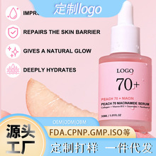 �羳�������ҟ��������AҺ������B�沿�aˮ���Aˮ�羳���R�d����