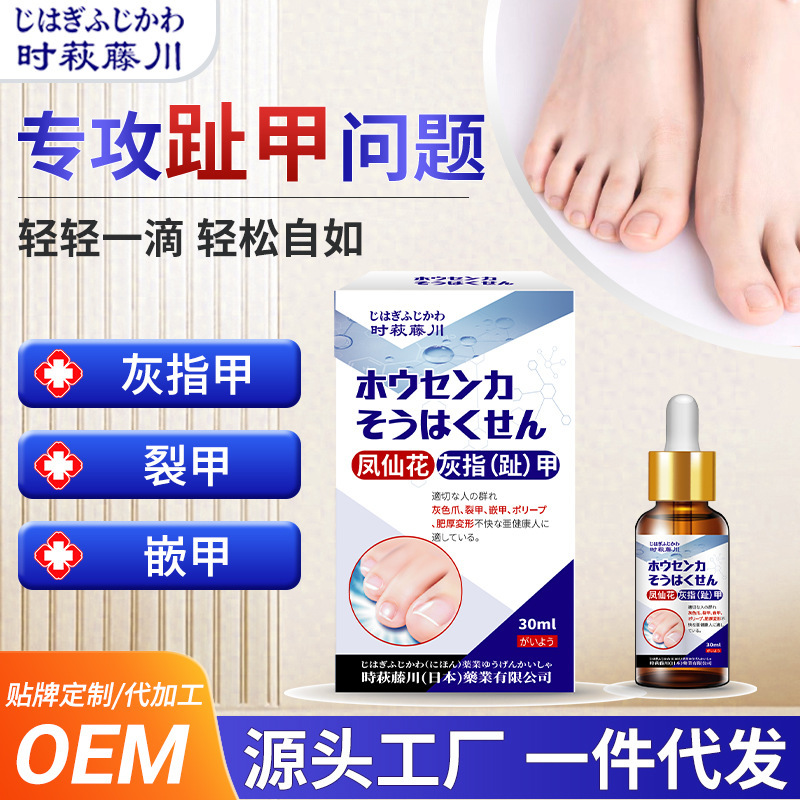 时萩藤川凤仙花灰指(趾)甲护理液舒缓不适灰指甲甲部亮甲外用液|undefined