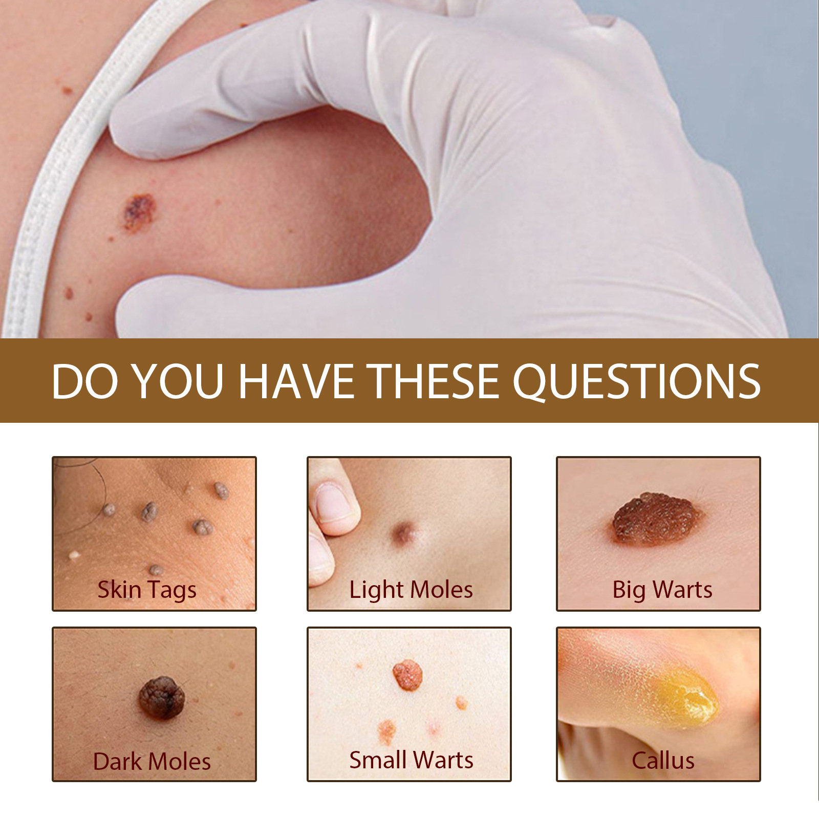 EELHOE wart oil repair for warts, black facial convex nevi, anti mole scar free nevus cocoon, clear and smooth skin_voghion.com