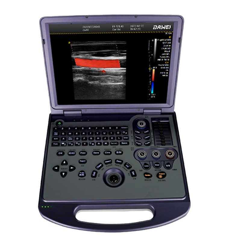 Ecógrafo portátil económico, ecógrafo portátil tipo B, máquina de ultrasonido, precio negociable para uso médico