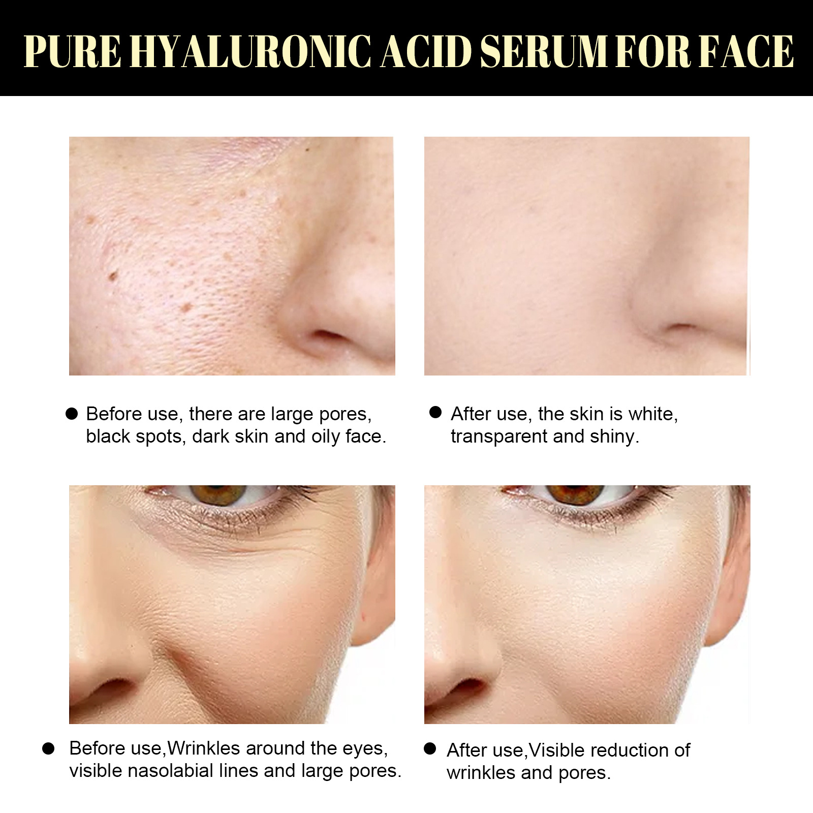 EELHOE Protein Boosting Line - Brightening Skin