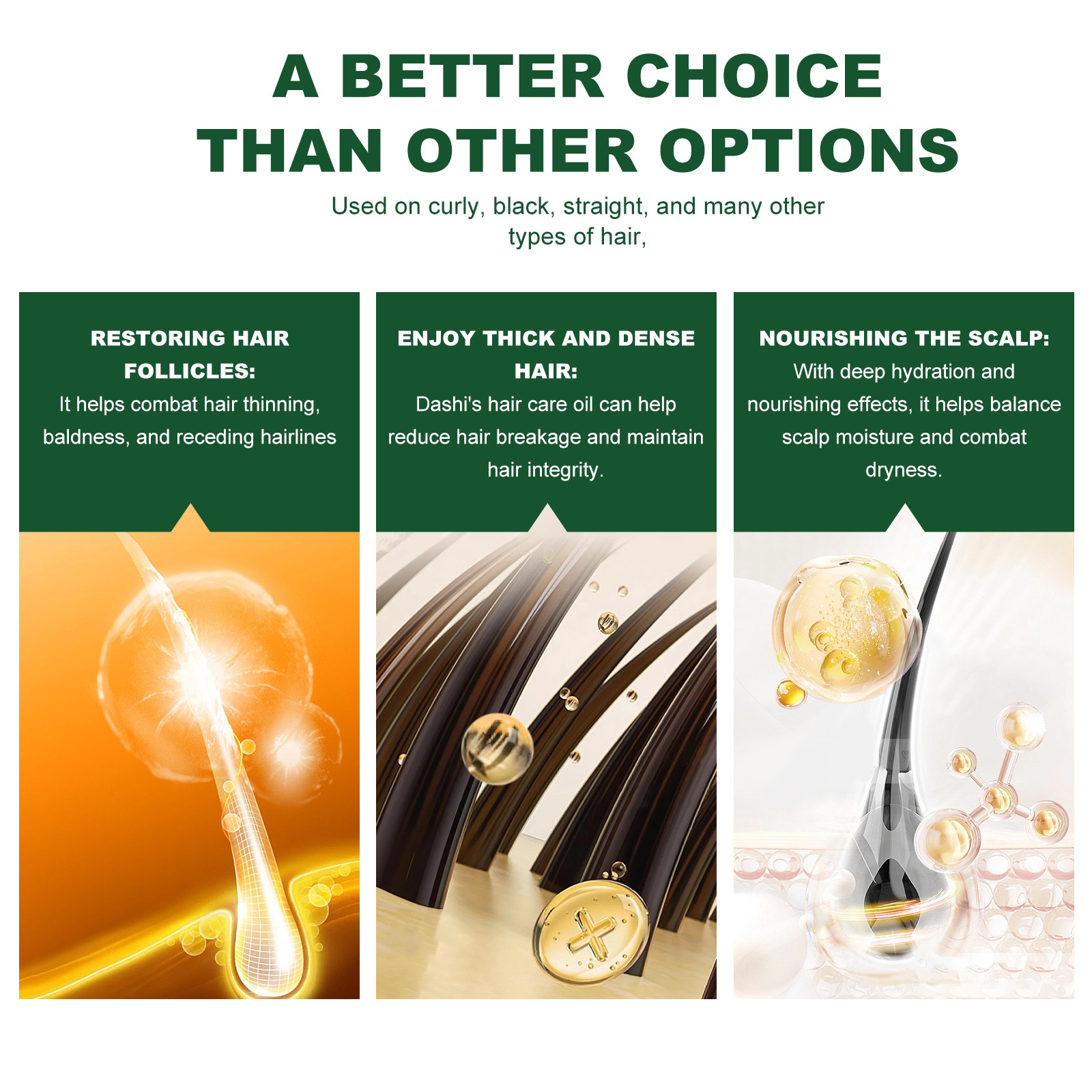 Das ätherische Rosmarin-Haaröl von EELHOE pflegt die Kopfhaut, beugt Haarausfall vor, verdichtet, spendet Feuchtigkeit und stärkt die Haarpflege_voghion.com