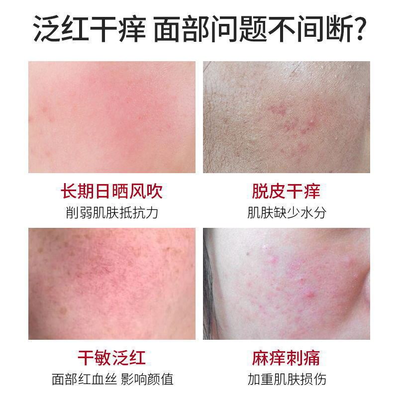 センテラ アジアティカ リペア クリーム 敏感肌を改善し、赤みを修復し、赤みを取り除き、ニキビ跡を除去します ビューティー サロン ライブ セル リペア クリーム|undefined