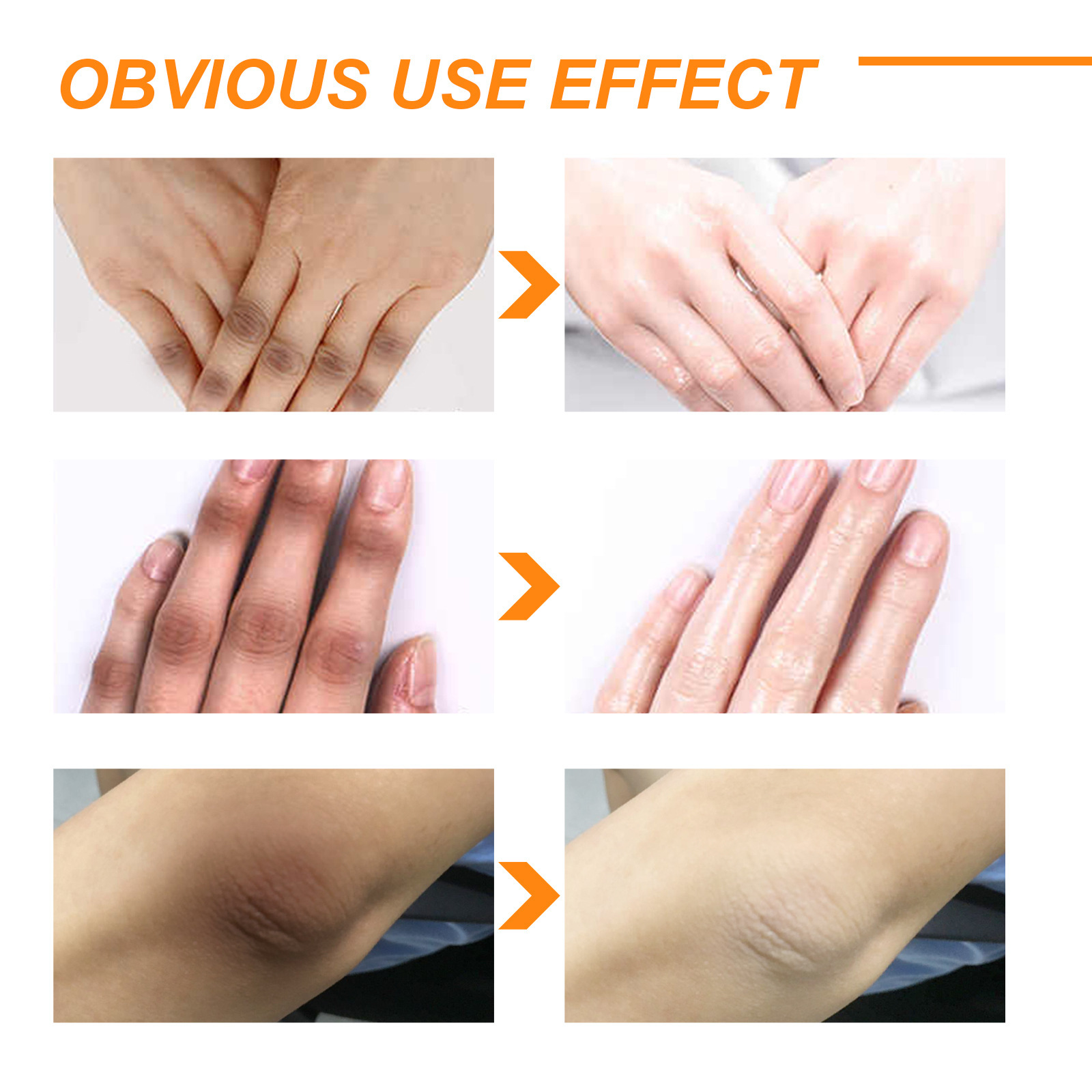 eelhoe Orangenschalen-Peeling-Gel, schwärzend, aufhellend, feuchtigkeitsspendend, aufhellend, Hautfarbe aufhellend und Melanin-Gel_voghion.com