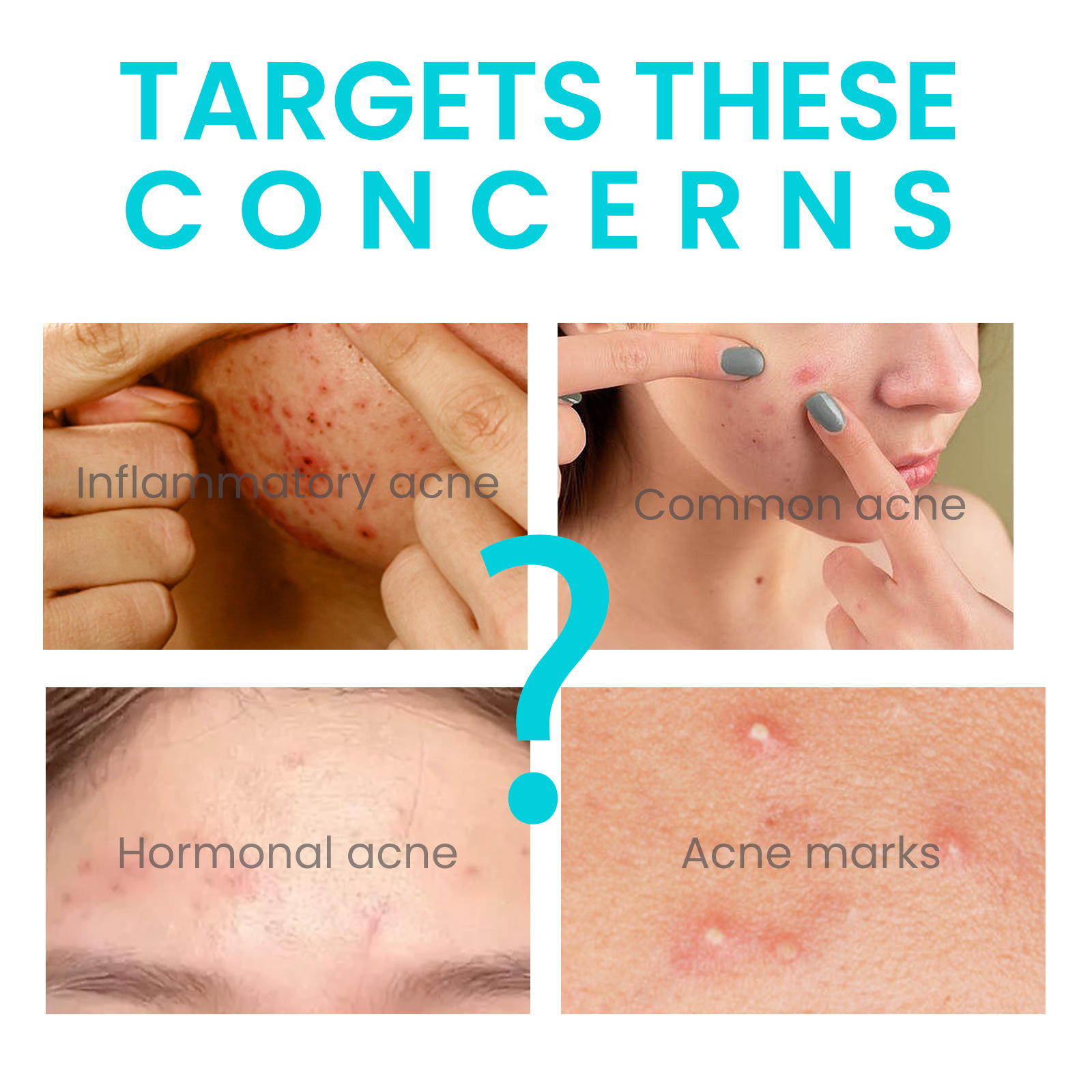 Crema antibrillante Jaysuing para reducir el acné, reducir los poros, hidratar y nutrir la piel,_voghion.com