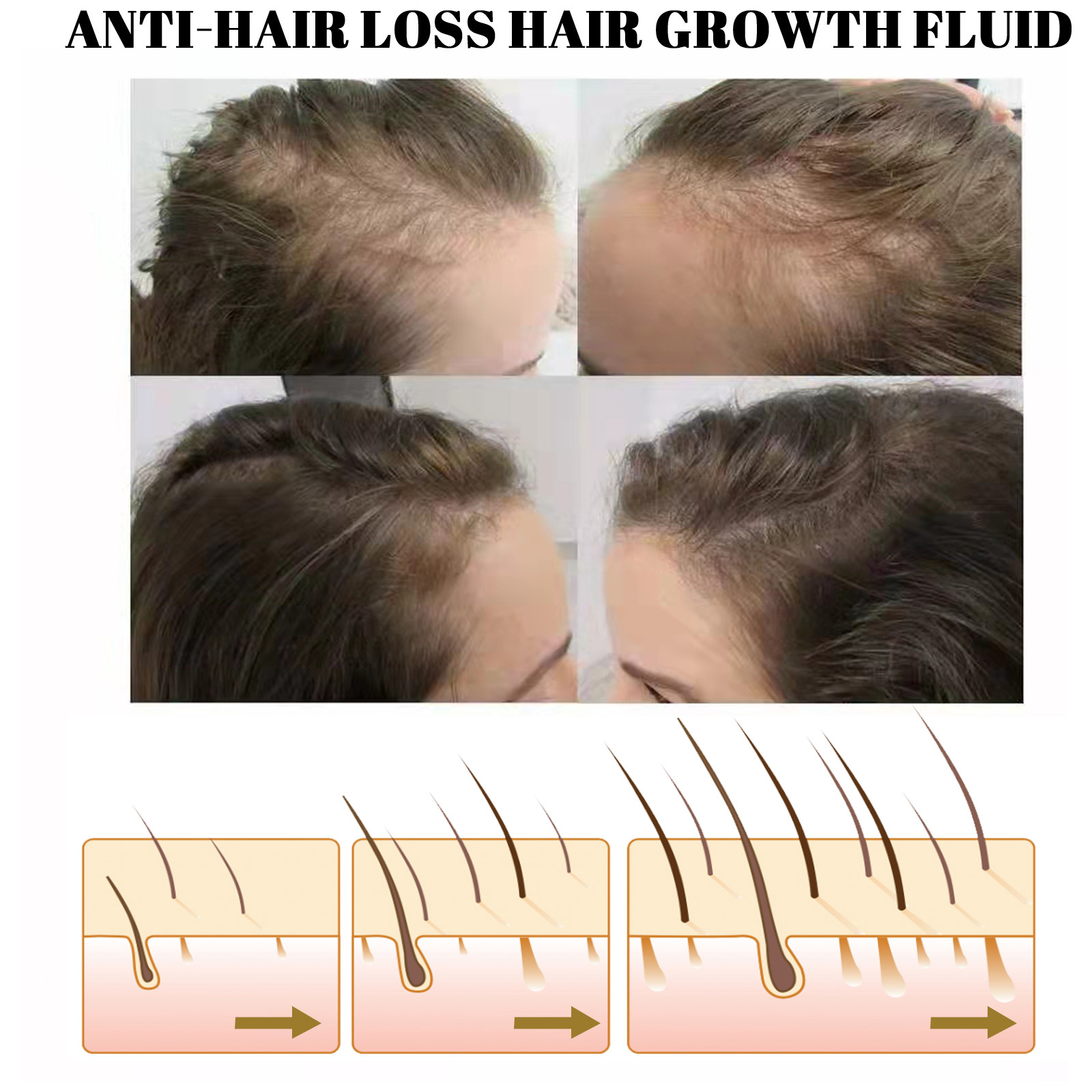 EELHOE Hair Growth Serum5