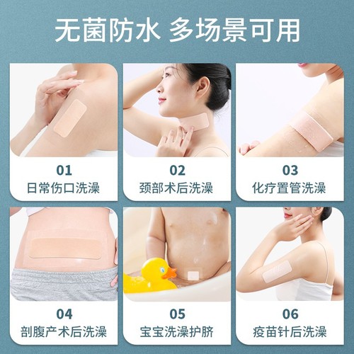 Kefu Medical Sterile Dressing Pouch Cesarean Section Waterproof Patch Shower Use Healing Patch Large Waterproof Bandage