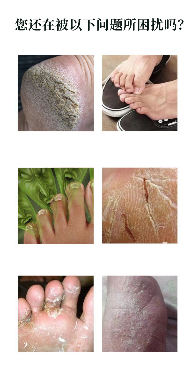 Wang Lang Du Ointment Foot Care External Herbal Balm 20g specifications