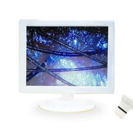 毛发检测仪  毛囊检测仪   头皮检测仪 毛发测试仪 1XX起便携