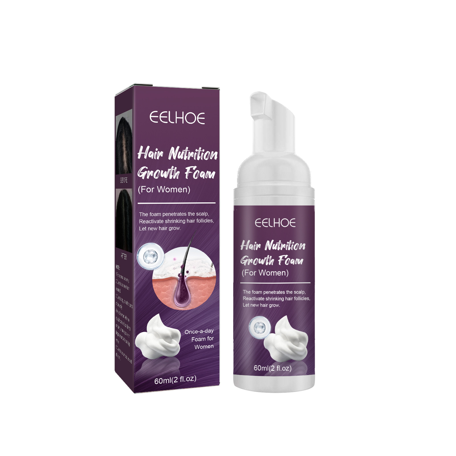 Tratamento em espuma de minoxidil para crescimento capilar_voghion.com