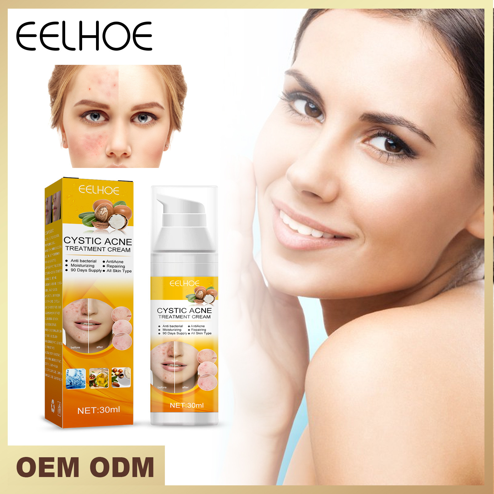 EELHOE Hautpflege reduziert Pickel, beseitigt Akne im Mund und verkleinert die Poren_voghion.com