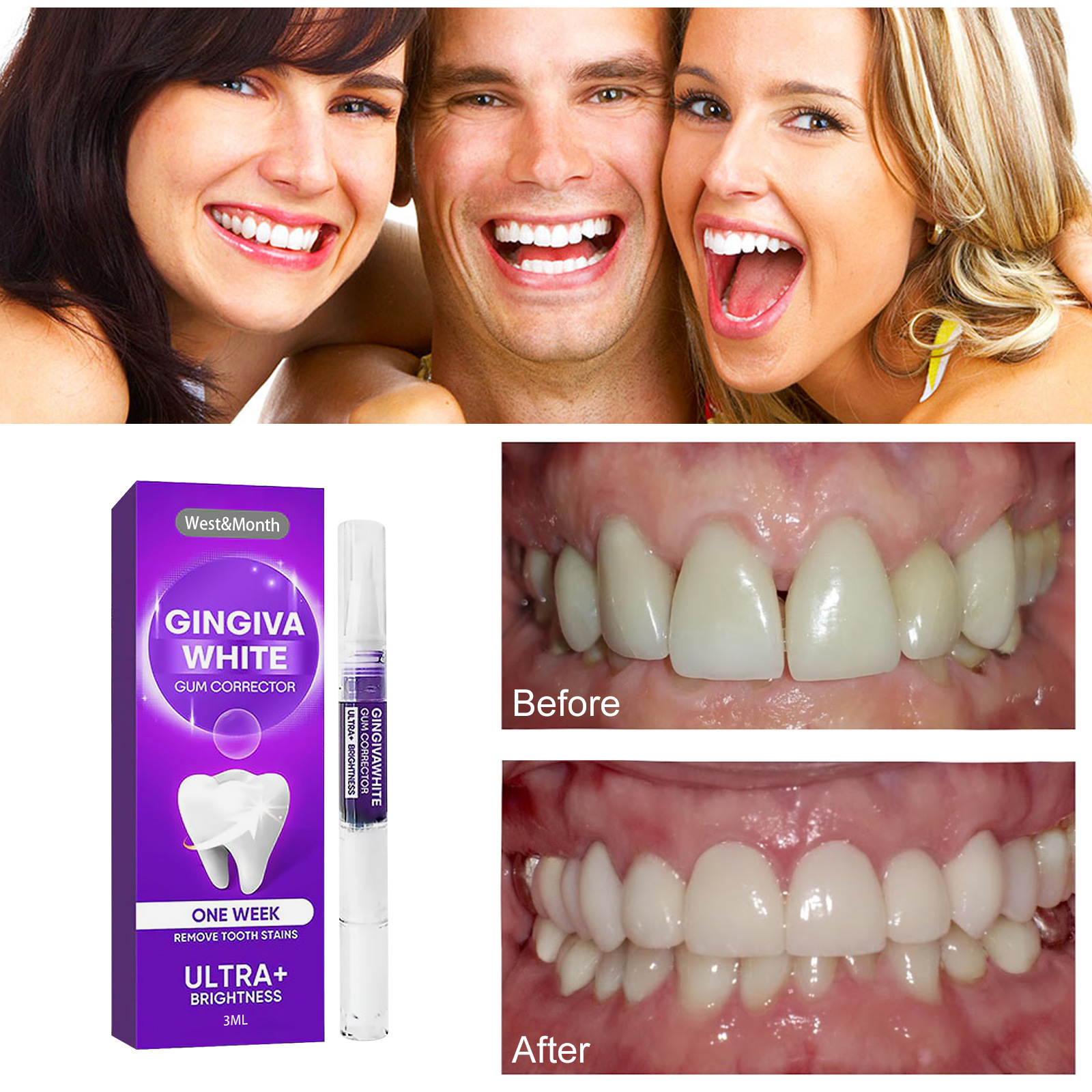 West&Month Dental Liquid Pen zur Reinigung von Verfärbungen, gelben Zähnen, Aufhellung, Aufhellung und Zahnfleischentfernung_voghion.com