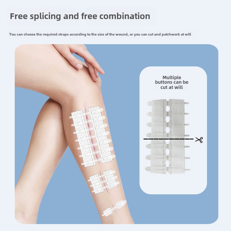 Honsen Tension Reliever Wound Closure Device, Non-woven Zipper Style Wound Dressing, Skin Tension Reliever Staple Device