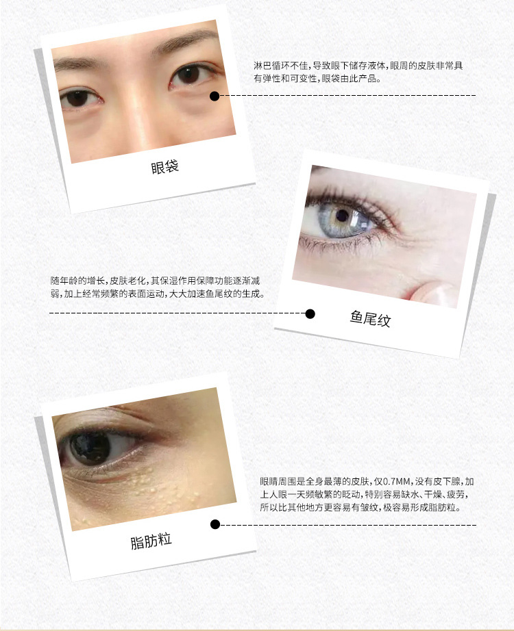New Eye Beauty Device Eye Essence Introduction Machine Electric Beauty Instrument Anti-Wrinkle Acne Treatment Dark Circle Removal Massage Machine Wholesale Firming