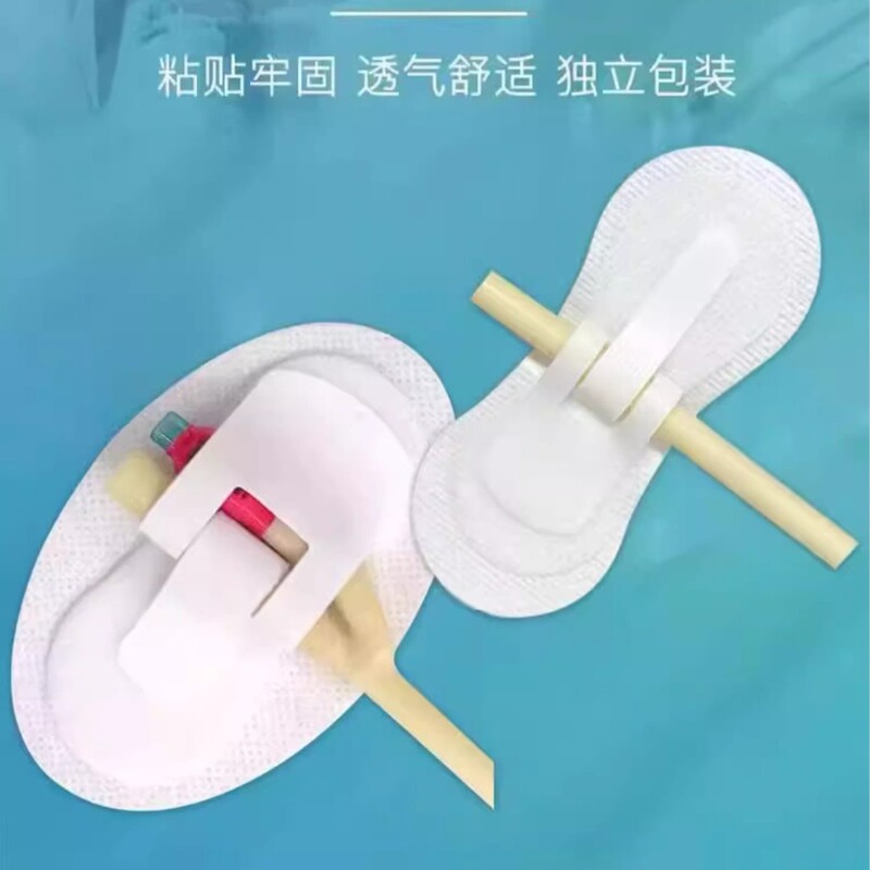 Tuoneng body surface catheter fixing patch catheter drainage tube catheter fixing device gastric tube tape nasal patch nasal feeding tube