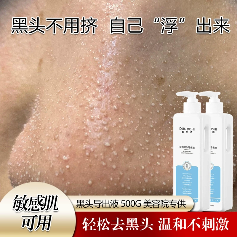 Салон красоты специализируется на удалении черных точек, очищении, сужении пор, лечении акне с помощью микропузырьков, и экстрактом фруктовых кислот для контроля жирности кожи в Т-зоне.