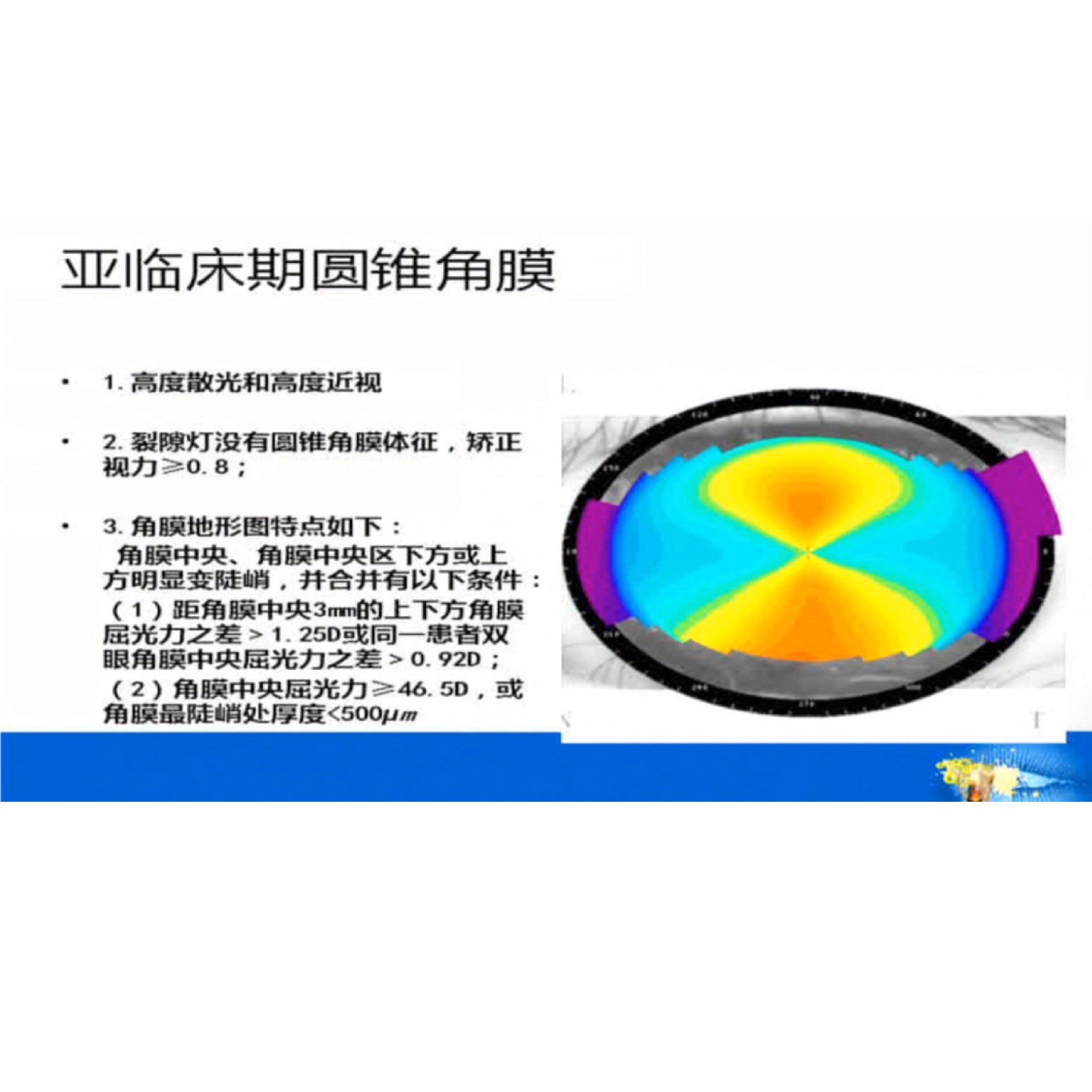 Ӱ�����ⲻ�������ĳ����۲� �γ�����