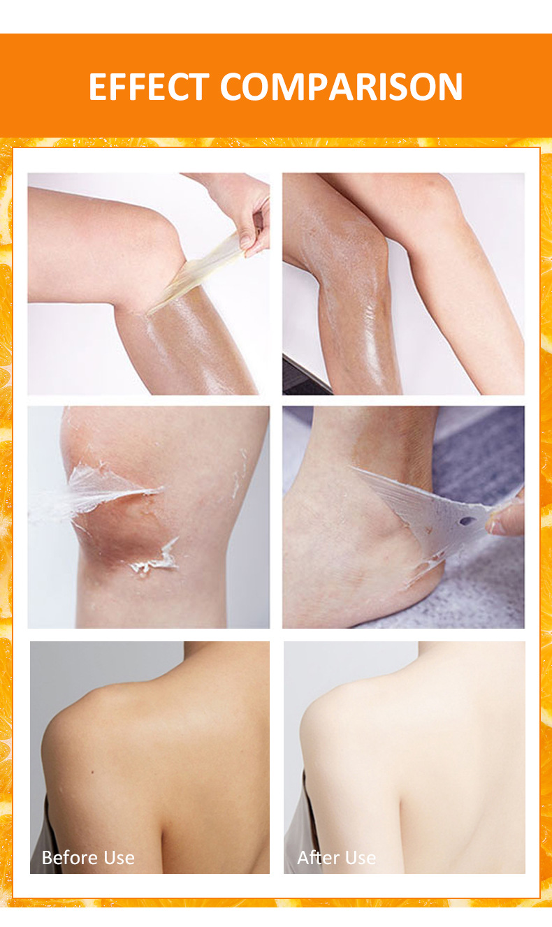 Orange peel lotion peeling oleic acid salicylic acid body milk mild Exfoliating gel