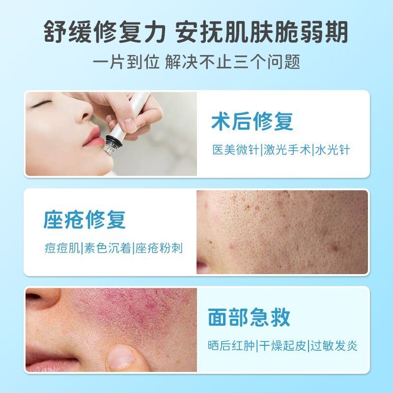 妥能医用术后修复痘痘敏感肌透明质酸钠修复贴冷敷贴医美非面膜械|undefined