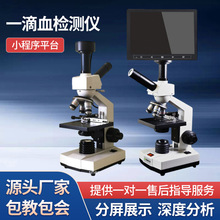 �羳�G���@΢�RѪҺѪ�����^�����һ��Ѫ�z�y�x301M��yʽ���@