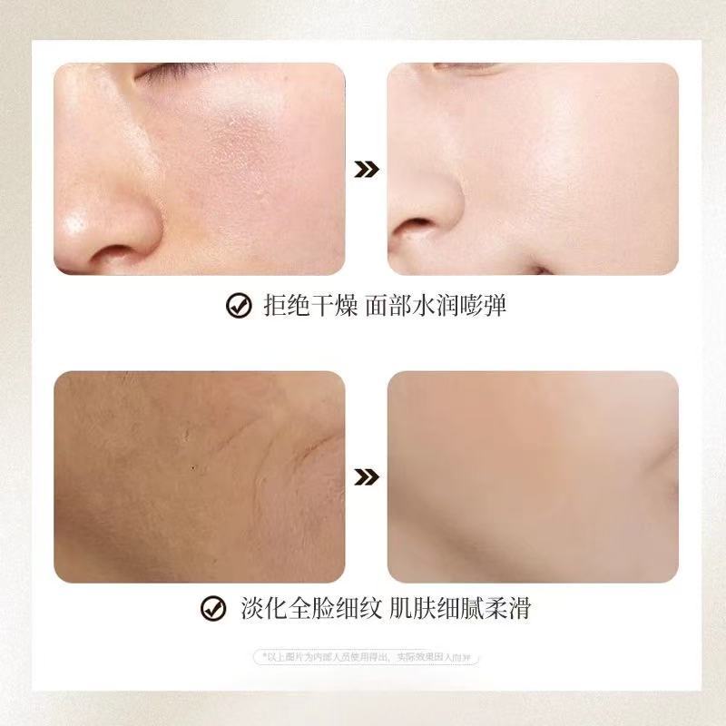 Aceite Facial de Esencia Antiarrugas, Hidratante, Iluminador