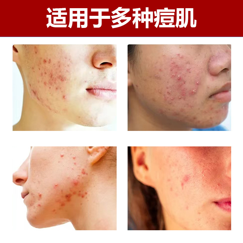 卡通猫咪20粒可爱痘痘盒装贴遮痘吸老人24粒遮盖跨境速卖通现货|undefined
