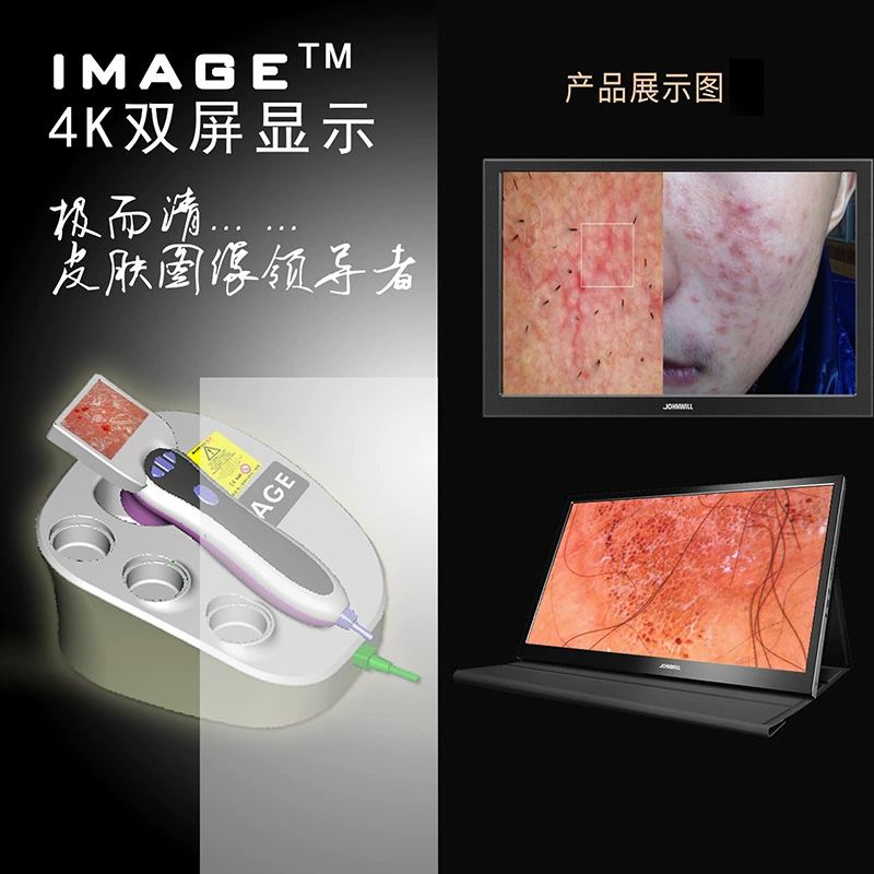 [Пожизненная гарантия] CBS-806 Тайваньский завод по тестированию и анализу кожи Сменные линзы