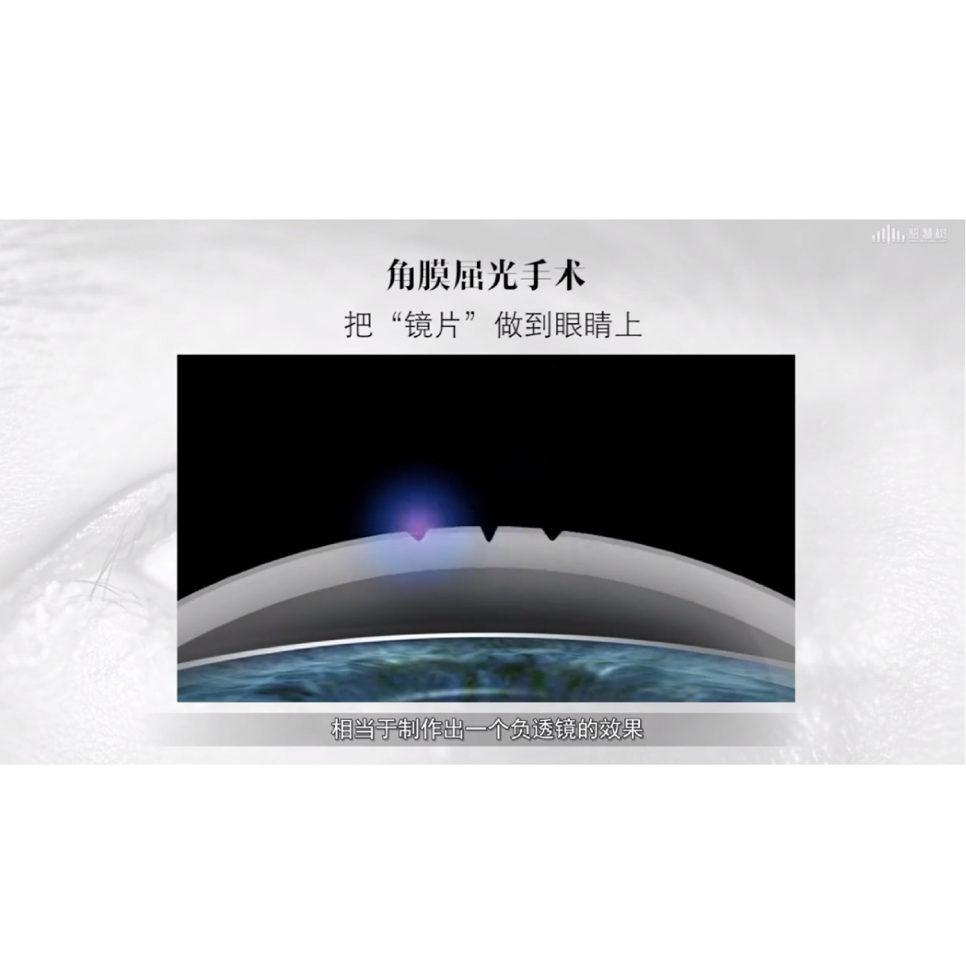 ���Ӻ������ȷ����4���������� �γ�����