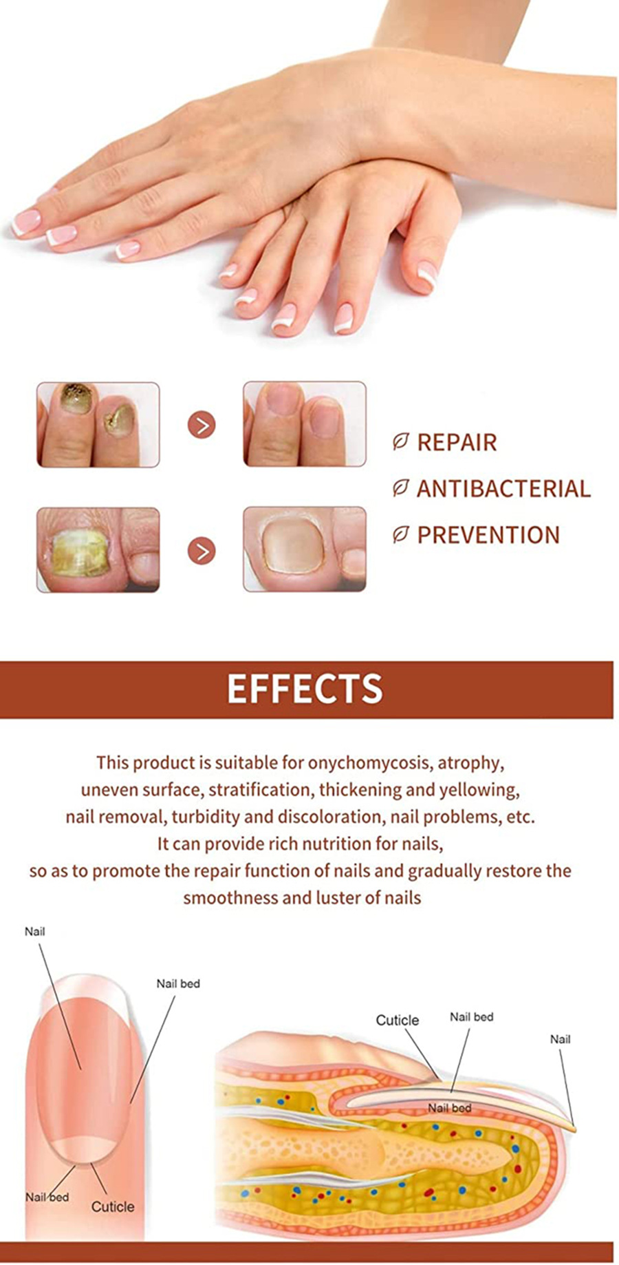 Crema desmaquillante antibacteriana especial para uñas, espesante para uñas suaves, y solución especial para uñas grises s,s_voghion.com